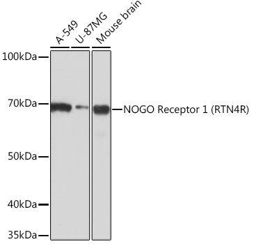 NOGO Receptor 1 (RTN4R) Monoclonal Antibody [1R9A3]
