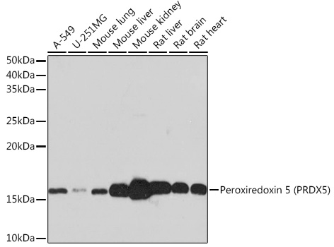 Peroxiredoxin 5 (PRDX5) Monoclonal Antibody [5E10D3]