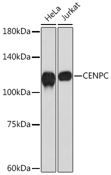 CENPC Monoclonal Antibody [5E3K5]