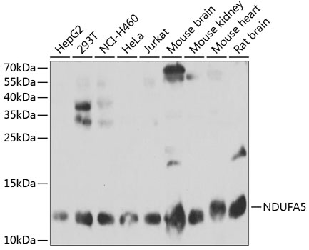 NDUFA5 Polyclonal Antibody