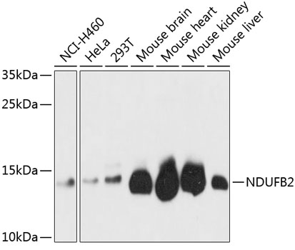 NDUFB2 Polyclonal Antibody