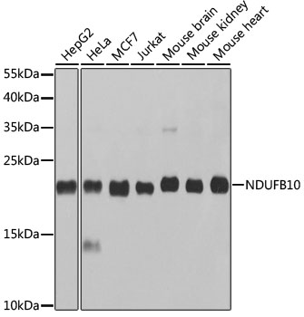 NDUFB10 Polyclonal Antibody