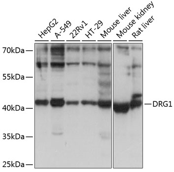 DRG1 Polyclonal Antibody