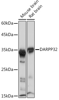 DARPP32 Monoclonal Antibody [5T9G4]