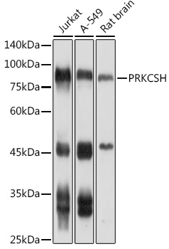 PRKCSH Polyclonal Antibody