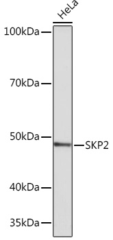 SKP2 Monoclonal Antibody [2L0K1]
