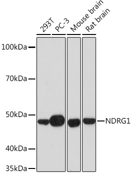 NDRG1 Monoclonal Antibody [2C6K6]