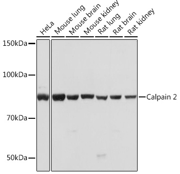 Calpain 2 Monoclonal Antibody [9Y7I1]