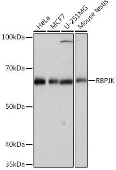 RBPJK Monoclonal Antibody [9B3L6]