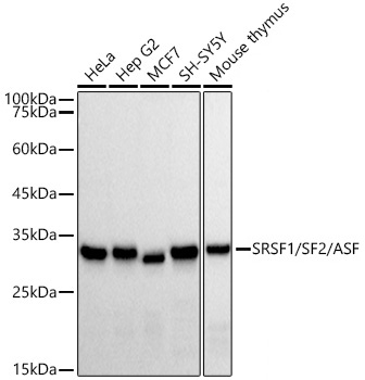 SRSF1/SF2/ASF Monoclonal Antibody [3J5Q9]