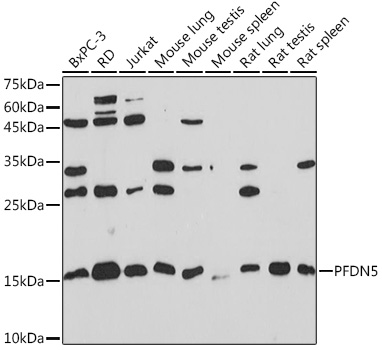 PFDN5 Monoclonal Antibody [9Y5H7]