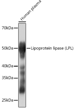 Lipoprotein lipase (LPL) Monoclonal Antibody [10E10P9]