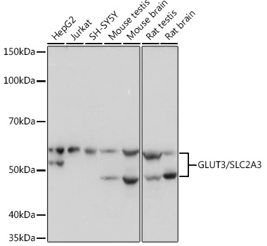 GLUT3/SLC2A3 Monoclonal Antibody [6T3F2]