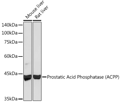 Prostatic Acid Phosphatase (ACPP) Monoclonal Antibody [1I6S7]