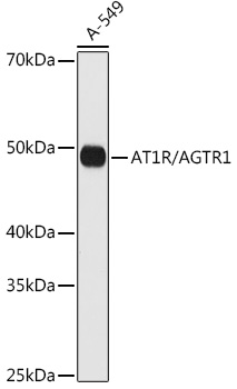 AT1R/AGTR1 Monoclonal Antibody [8W6G0]