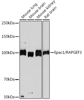 Epac1/RAPGEF3 Monoclonal Antibody [5A7K7]