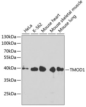 TMOD1 Polyclonal Antibody