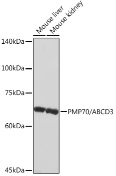 PMP70/ABCD3 Monoclonal Antibody [3V4K3]