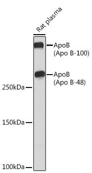 ApoB Monoclonal Antibody [2T5X0]