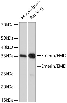 Emerin/EMD Monoclonal Antibody [10Y5K9]