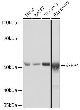 SFRP4 Monoclonal Antibody [7Z6Q1]