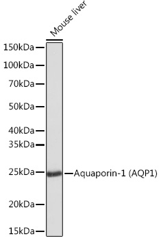 Aquaporin-1 (AQP1) Monoclonal Antibody [8V1O3]