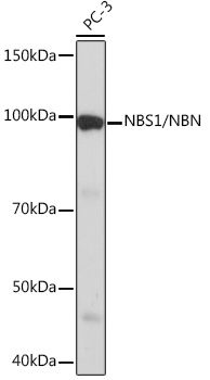NBS1/NBN Monoclonal Antibody [4G4R1]