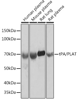 tPA/PLAT Monoclonal Antibody [10W4L1]
