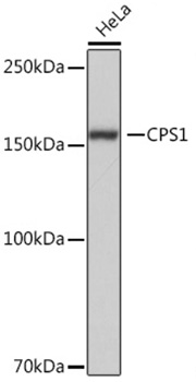 CPS1 Monoclonal Antibody [1R6W3]