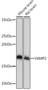 VAMP2 Monoclonal Antibody [8X9D9]