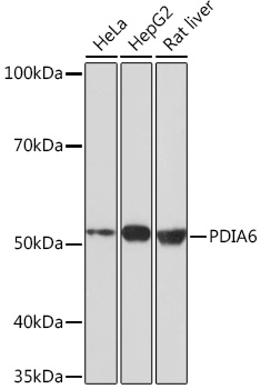 PDIA6 Monoclonal Antibody [2Q1L1]