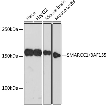 SMARCC1/BAF155 Monoclonal Antibody [1R7I6]