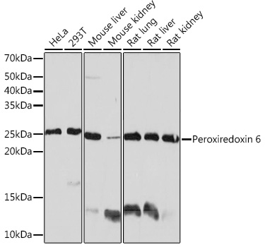 Peroxiredoxin 6 Monoclonal Antibody [1A9W5]