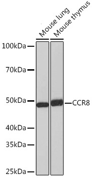 CCR8 Monoclonal Antibody [9N1Y1]