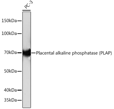 Placental alkaline phosphatase (PLAP) Monoclonal Antibody [10Q2X7]