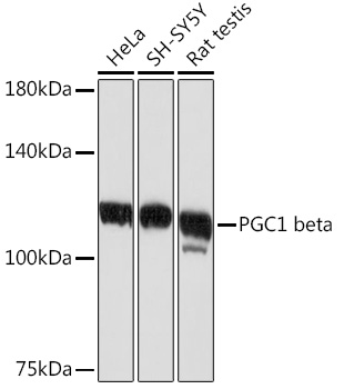 PGC1 beta Monoclonal Antibody [3K4V1]