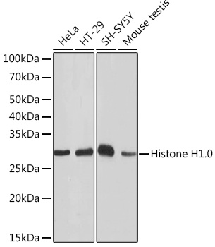 Histone H1.0 Monoclonal Antibody [5E3Q8]