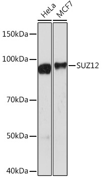 SUZ12 Monoclonal Antibody [1M3V2]