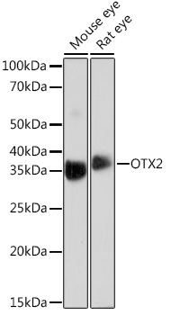 OTX2 Monoclonal Antibody [6I3J0]