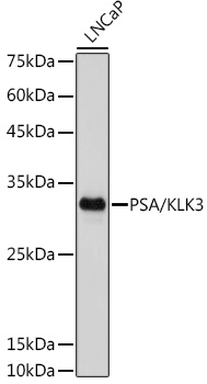 PSA/KLK3 Monoclonal Antibody [8K9R4]