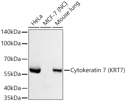 Cytokeratin 7 (KRT7) Monoclonal Antibody [5V4M10]