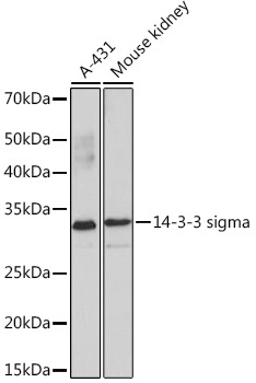 14-3-3 sigma Monoclonal Antibody [8C8A9]&nbsp;<img src="images/icon_newarrival.gif" alt="new" border="0">