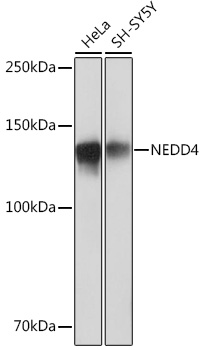 NEDD4 Monoclonal Antibody [7R0M4]