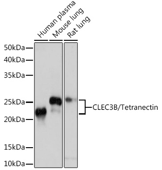 CLEC3B/Tetranectin Monoclonal Antibody [3E5Y7]