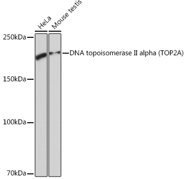 DNA topoisomerase II alpha (TOP2A) Monoclonal Antibody