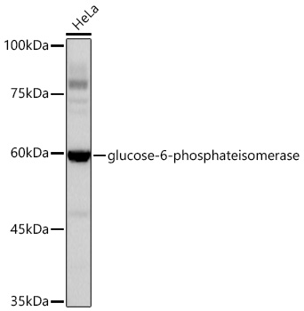 glucose-6-phosphate isomerase Monoclonal Antibody [2Y8R0]&nbsp;<img src="images/icon_newarrival.gif" alt="new" border="0">