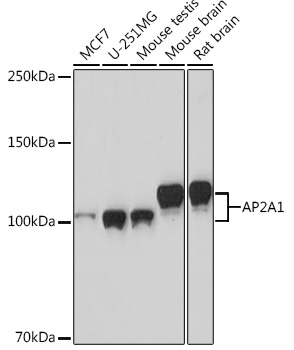 AP2A1 Monoclonal Antibody [8R8B6]