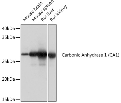 Carbonic Anhydrase 1 (CA1) Monoclonal Antibody [0G10F8]
