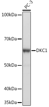 DKC1 Monoclonal Antibody [2W2V6]