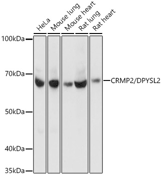 CRMP2/DPYSL2 Monoclonal Antibody [0A1T1]